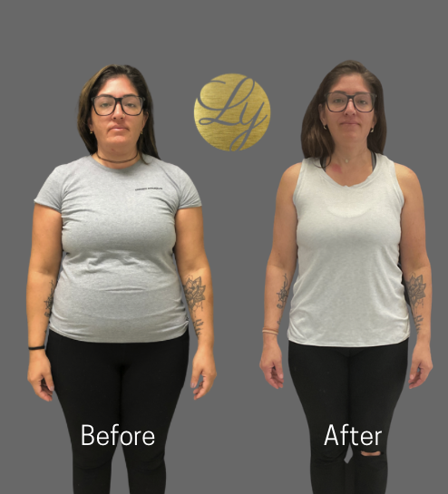 how long does it take to lose weight microdosing semaglutide Semaglutide Weight Loss: A Comprehensive Guide