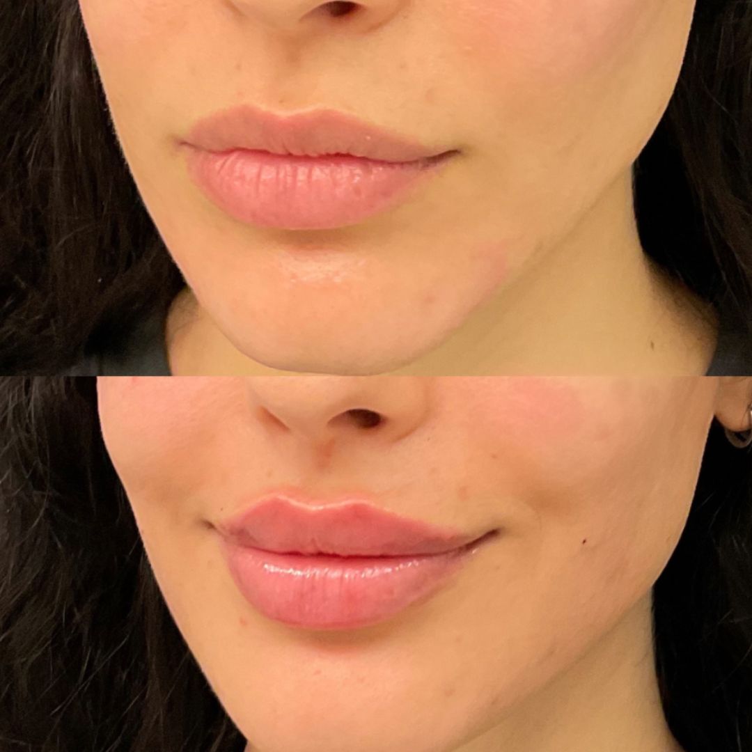 xr:d:DAFmXDHNxHc:6,j:5611904563444147654,t:24022123