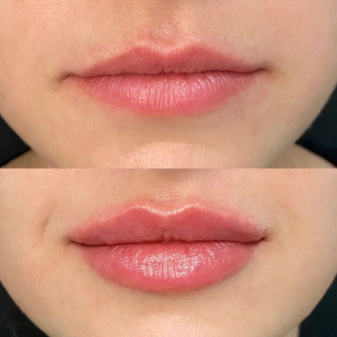 xr:d:DAFm72u1bjw:7,j:7621635898361160919,t:24022123