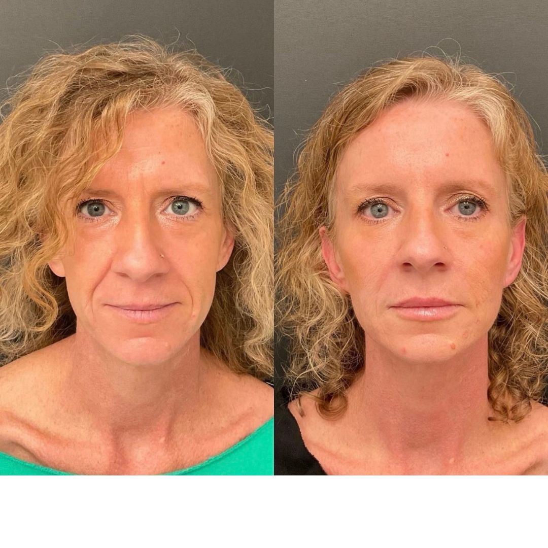 xr:d:DAFnCUQbwqo:189,j:25189224785360547,t:24022123