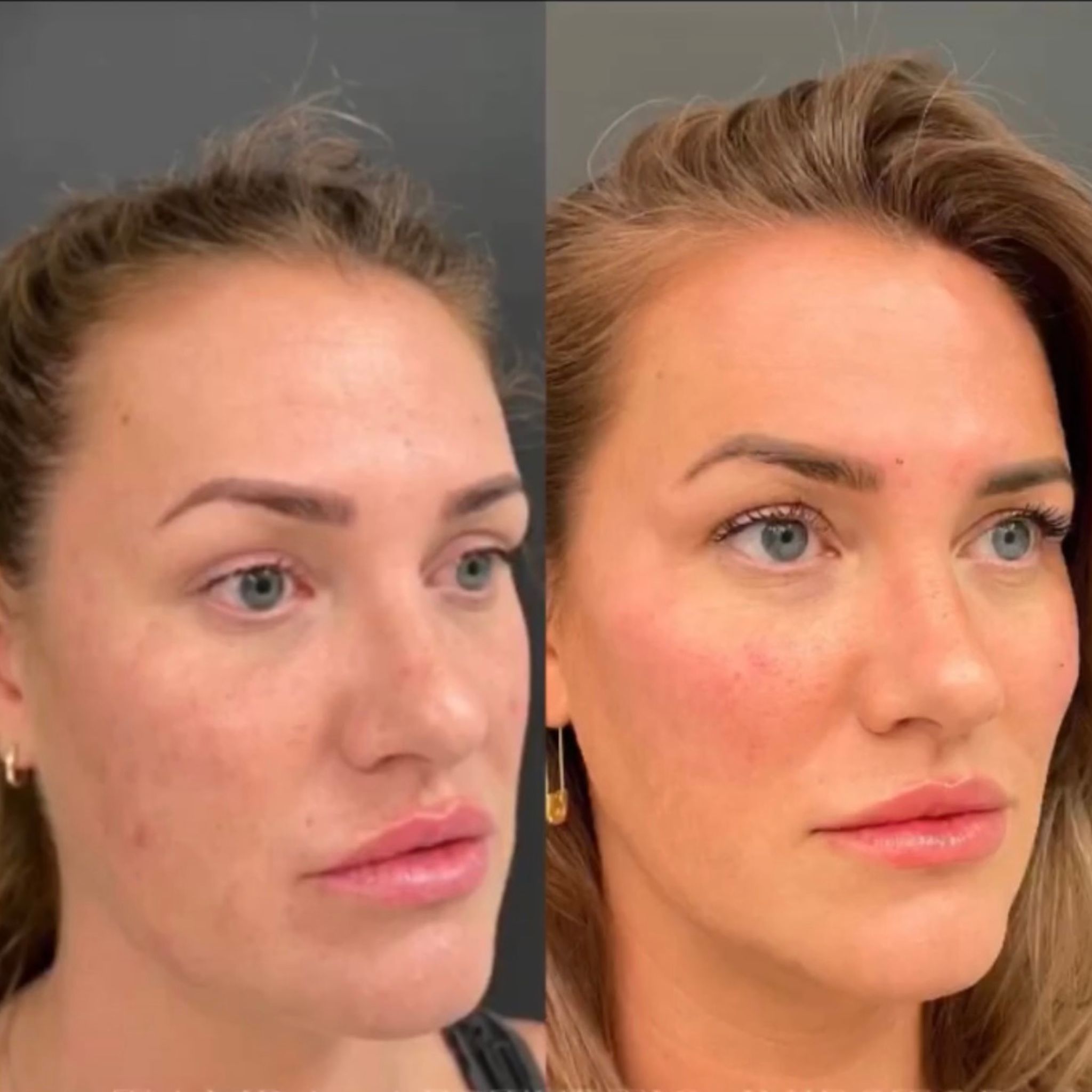 xr:d:DAFjwph5K6Y:18,j:6359502102441460779,t:24022123