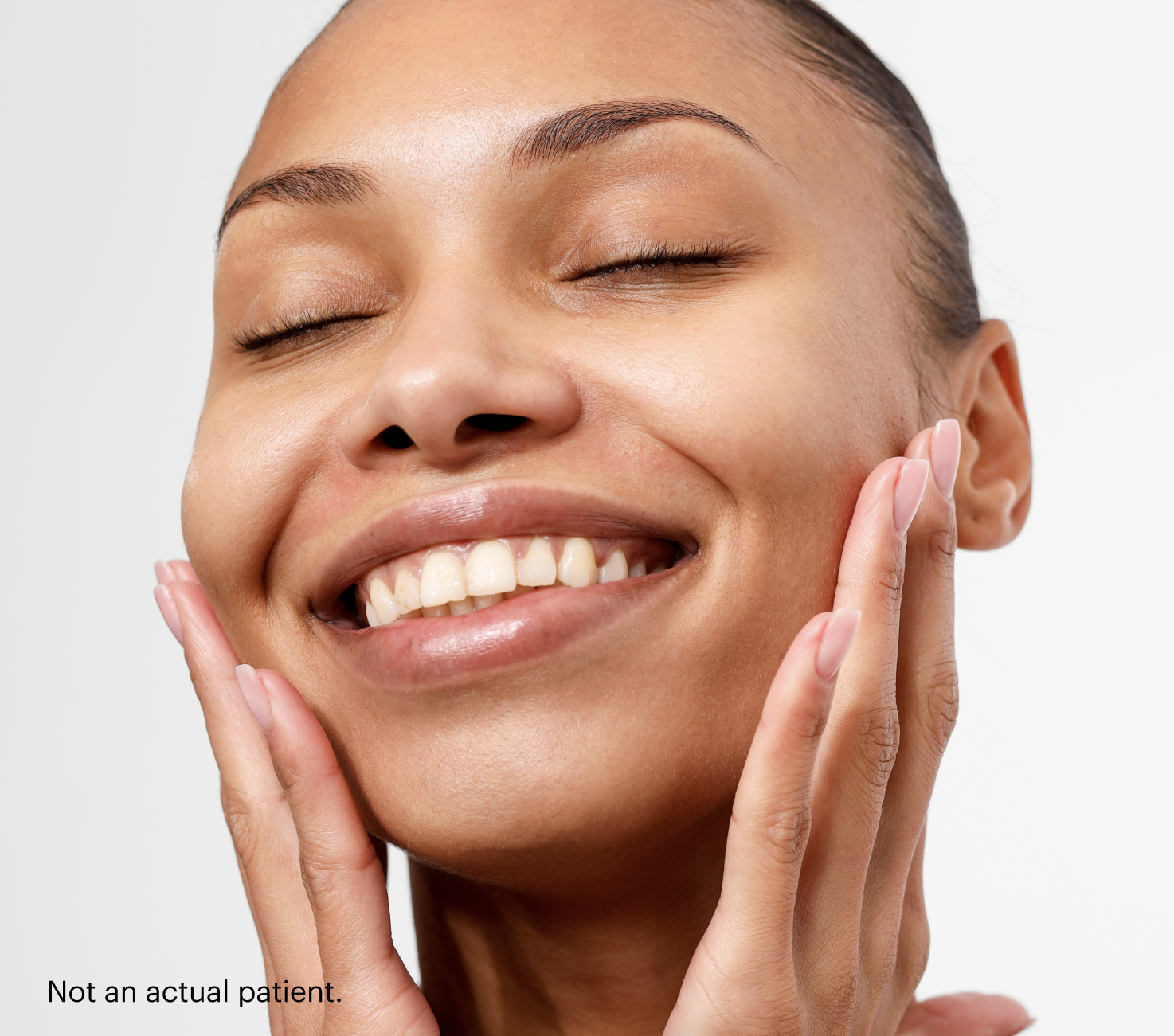 natural look and fillers